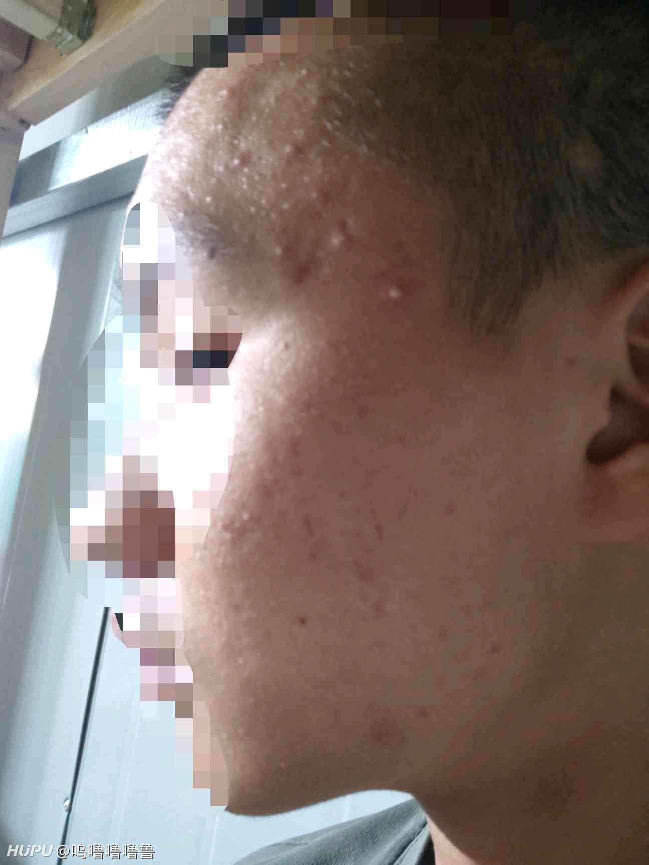 真话屋 二十年皮肤病大夫 不懂就问吧 19年8月日虎扑存档 看帖神器