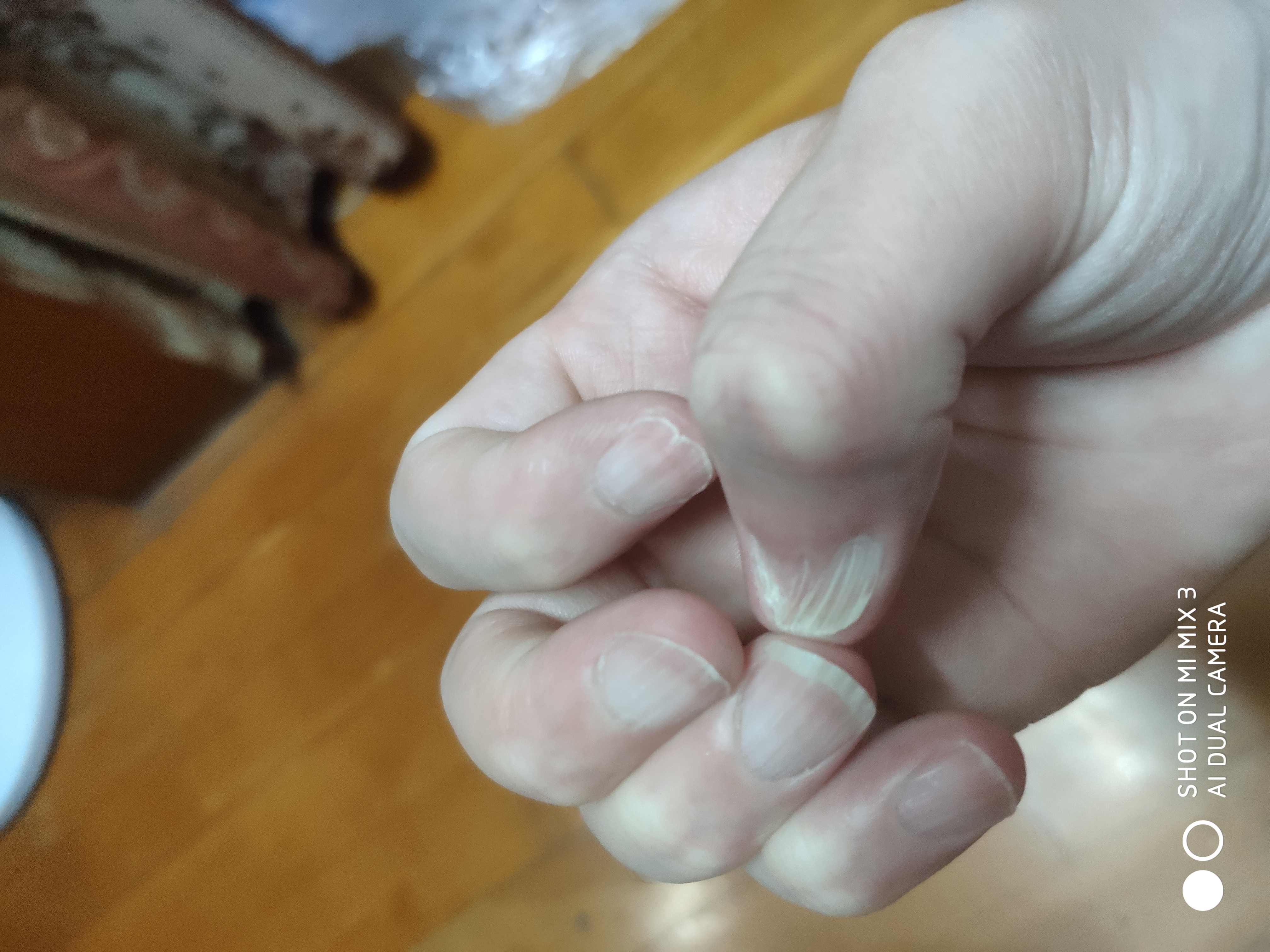 真话屋 二十年皮肤病大夫 不懂就问吧 19年8月日虎扑存档 第3 页 看帖神器 真话屋 二十年皮肤病大夫 不懂就问吧 19年8月日虎扑存档 第3 页 看帖神器