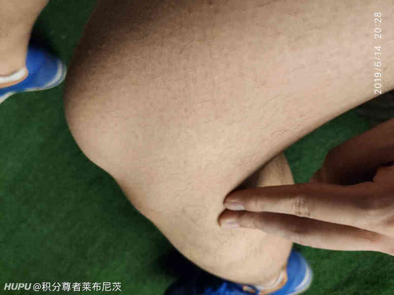 各位大肌霸们,练大腿肌群膝关节侧面痛是怎么回事啊?
