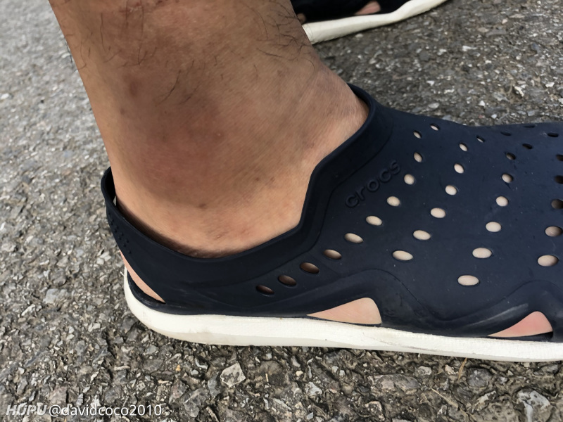 2k4的确是一双好鞋可惜对我有毒前叉韧带断裂脚踝韧带撕裂拜他所赐拜拜了 虎扑