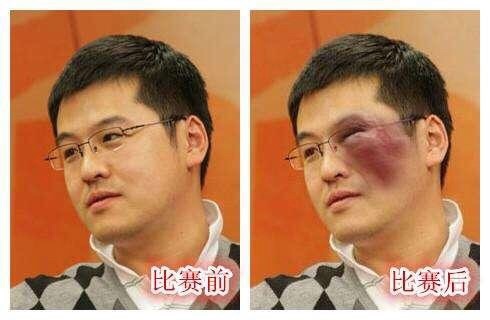 评论杨毅微博被拉黑了