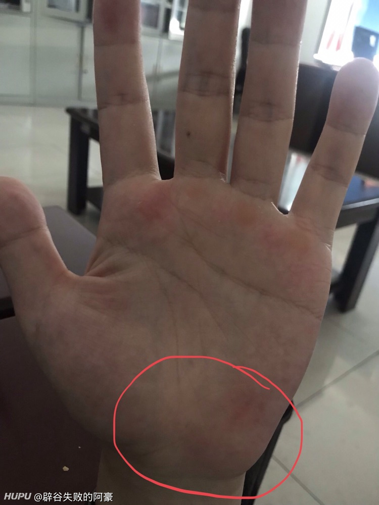 做握推的时候手腕立起来压的手掌骨疼