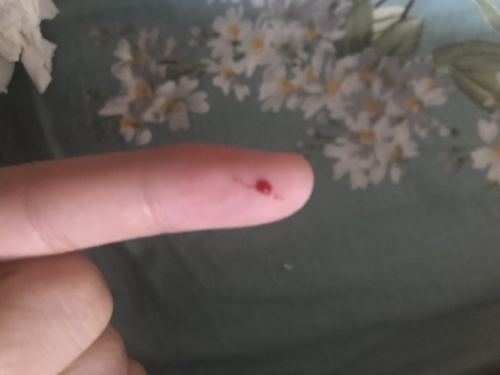 被家猫挠出血，十天后猫还活着是否证明猫没病毒？今天又被咬出血了，就 