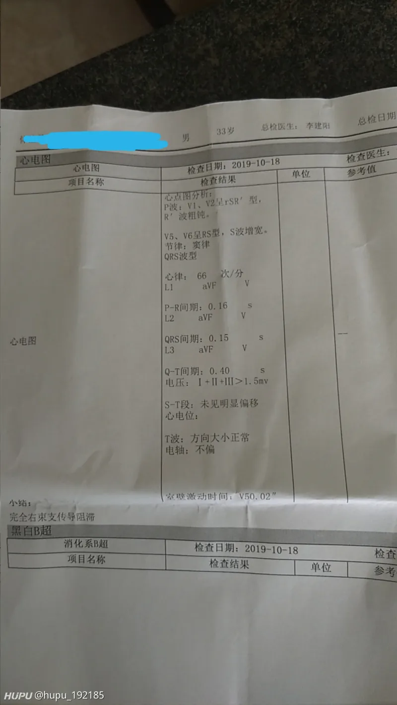 请问心电图完全右束支传导阻滞是怎么回事 步行街主干道 虎扑社区