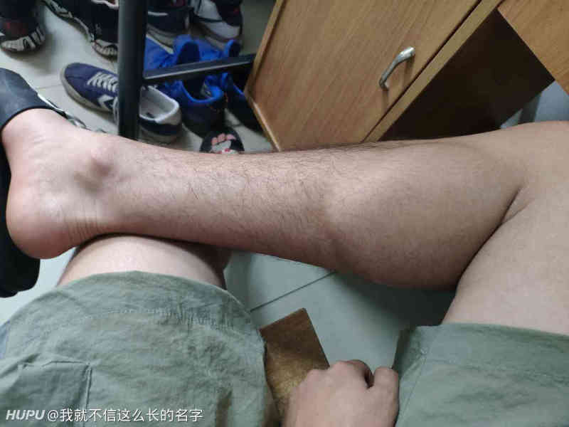 楼主这跟腱什么水平