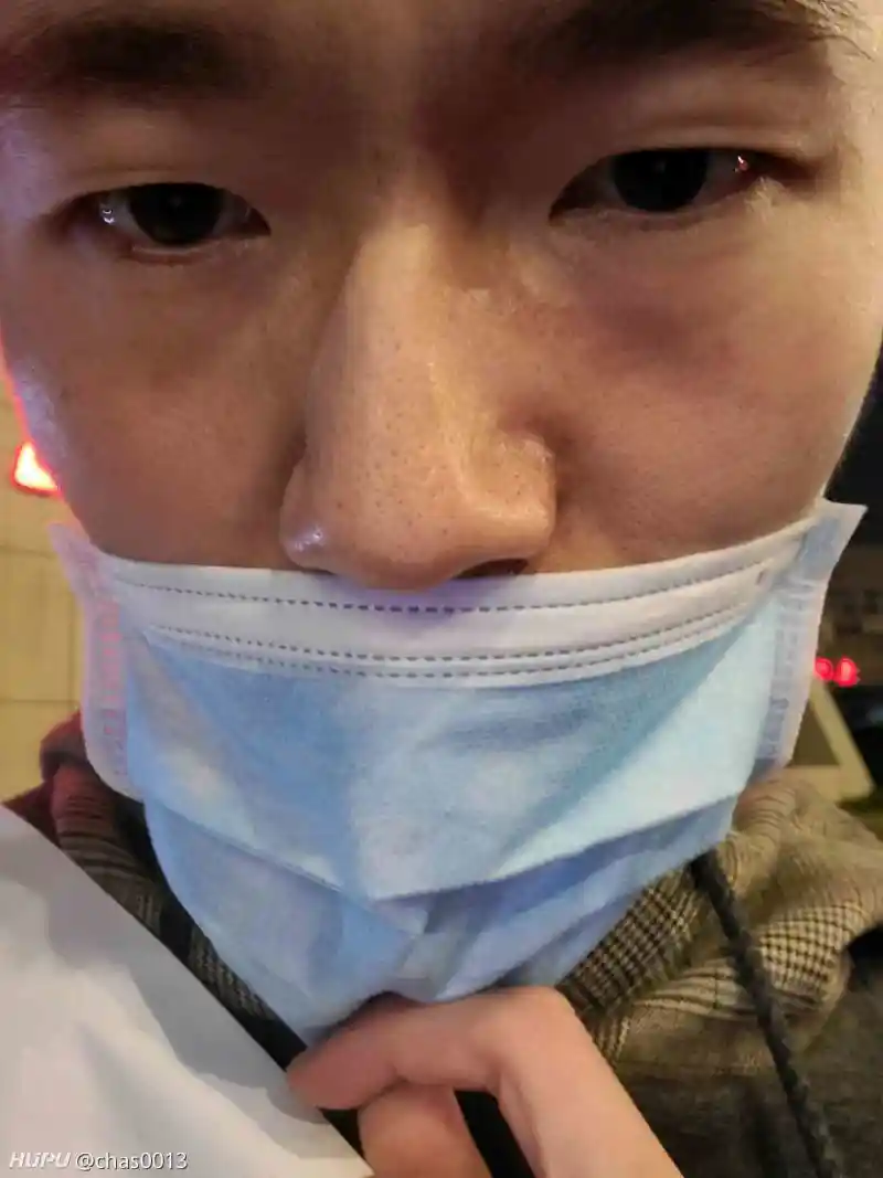 打球鼻子骨折了 湿乎乎的话题 虎扑社区 打球鼻子骨折了 湿乎乎的话题 虎扑社区
