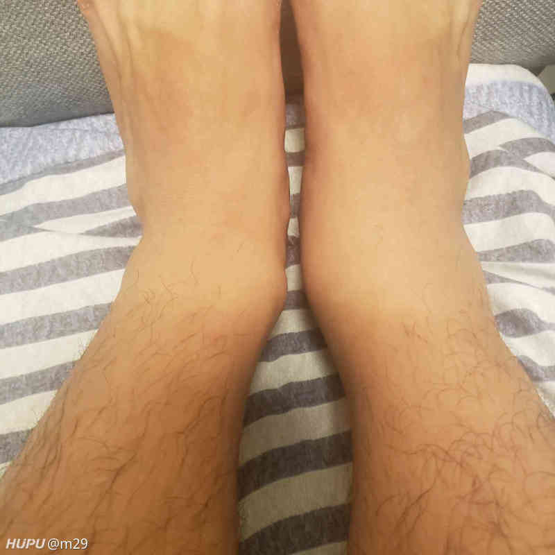 Jrs 懂得来看下脚踝扭伤有没有什么恢复建议 虎扑