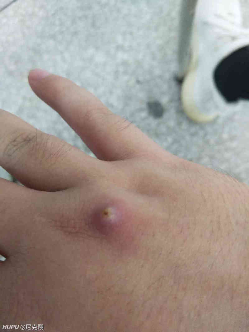 有老哥知道我这是个啥吗?